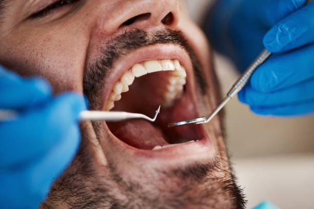 Best Broken Tooth Emergency  in Bertville, AL